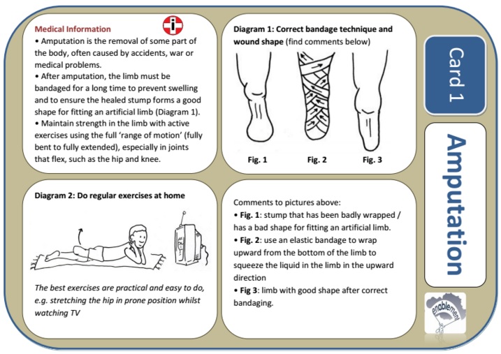 Example flashcard amputation Example flashcard amputation